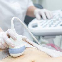 gynakologefuhrtultraschallunters